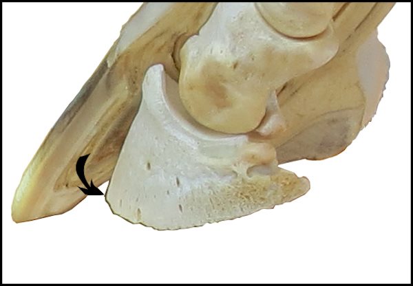 Image 4Crosssection of foot showing (600px * 416px)